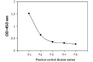 Jurkat cells were treated with Pervanadate. (DDR1 ELISA Kit)