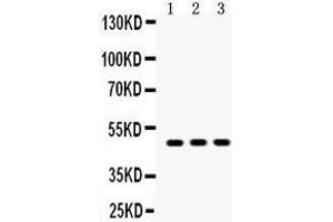 Western Blotting (WB) image for anti-Sequestosome 1 (SQSTM1) (AA 69-96), (N-Term) antibody (ABIN3043937) (SQSTM1 antibody  (N-Term))