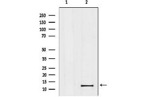 Western blot analysis of lysates from Hela, using ME Antibody.