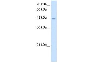 TMPRSS11D antibody used at 2. (TMPRSS11D antibody  (N-Term))