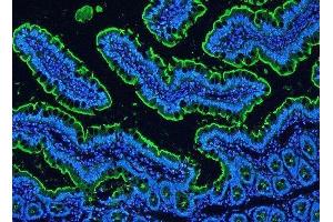IF analysis of Villi using anti-Villi antibody (ABIN3042343) Villi was detected in paraffin-embedded section of rat intestine tissues. (Villin 1 antibody  (C-Term))