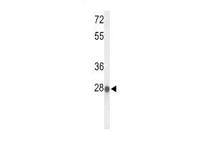 Western blot analysis of ABHDB Antibody (Center) (ABIN653369 and ABIN2842841) in MCF-7 cell line lysates (35 μg/lane). (ABHD11 antibody  (AA 176-205))