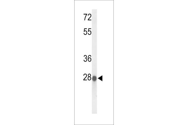 ABHD11 antibody  (AA 176-205)