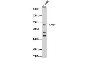 Western blot analysis of extracts of HepG2 cells, using CRNN antibody (ABIN6127877, ABIN6139056, ABIN6139057 and ABIN6224784) at 1:1000 dilution. (CRNN antibody  (AA 396-495))
