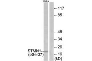 Western blot analysis of extracts from HeLa cells treated with nocodazole, using Stathmin 1 (Phospho-Ser37) Antibody. (Stathmin 1 antibody  (pSer38))