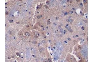 Detection of DKK3 in Rat Cerebrum Tissue using Polyclonal Antibody to Dickkopf Related Protein 3 (DKK3) (DKK3 antibody  (AA 41-348))