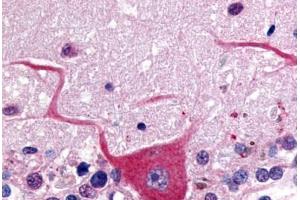 Human Brain, Cerebellum (formalin-fixed, paraffin-embedded) stained with GPR32 antibody ABIN213488 at 20 ug/ml followed by biotinylated goat anti-rabbit IgG secondary antibody ABIN481713, alkaline phosphatase-streptavidin and chromogen. (GPR32 antibody  (C-Term))