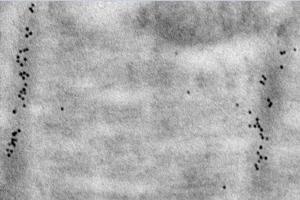 Immunoelectron microscopy analysis of LR white resin-embedded mouse heart using alpha Actinin 2 (ABIN7075510) at dilution of 1: 50. (Sarcomeric alpha Actinin antibody)