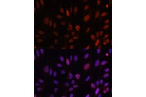 Immunofluorescence analysis of U-2 OS cells using HOXB1 antibody (ABIN6128032, ABIN6141942, ABIN6141943 and ABIN6222309) at dilution of 1:100. (HOXB1 antibody  (AA 35-180))