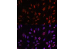 Immunofluorescence analysis of U-2 OS cells using HOXB1 antibody (ABIN6128032, ABIN6141942, ABIN6141943 and ABIN6222309) at dilution of 1:100.