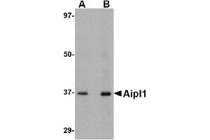 Western Blotting (WB) image for anti-Aryl Hydrocarbon Receptor Interacting Protein-Like 1 (AIPL1) (C-Term) antibody (ABIN1030229) (AIPL1 antibody  (C-Term))