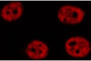 ABIN6272300 staining HeLa by IF/ICC. (FOXR1 antibody  (C-Term))