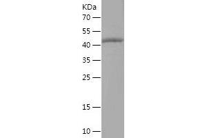 TRIM15 Protein (AA 5-215) (His-IF2DI Tag)