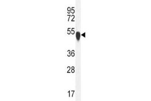 TUBA1C antibody  (AA 414-441)