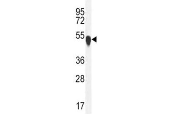 TUBA1C antibody  (AA 414-441)