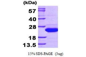 SDS-PAGE (SDS) image for Spermidine/spermine N1-Acetyltransferase 1 (SAT1) (AA 1-171) protein (His tag) (ABIN667745) (SAT1 Protein (AA 1-171) (His tag))