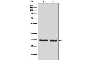 Western blot analysis of Skp1 expression in (1) 293T cell lysate, (2) NIH/3T3 cell lysate.