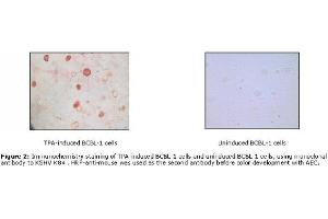 Image no. 1 for anti-KSHV K8 alpha antibody (ABIN478368) (KSHV K8 alpha antibody)