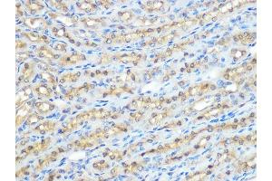 Immunohistochemistry of paraffin-embedded mouse kidney using PP1 beta Rabbit mAb (ABIN1679819, ABIN3018859, ABIN3018860 and ABIN7101675) at dilution of 1:100 (40x lens).