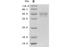 Interleukin 21 Receptor (IL21R) (AA 41-253) (Active) protein (His tag)