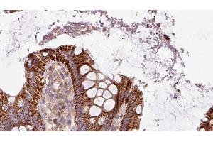 ABIN6272885 at 1/100 staining Mouse colon tissue by IHC-P. (Pallidin antibody  (C-Term))