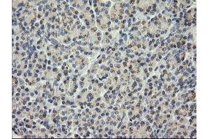Image no. 2 for anti-SEC14 and Spectrin Domains 1 (SESTD1) antibody (ABIN1501065) (SESTD1 antibody)