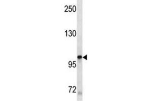 KIT antibody western blot analysis in A549 lysate