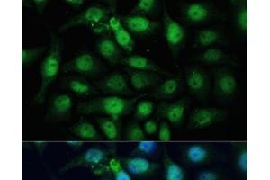 Immunofluorescence analysis of HeLa cells using ZWINT Polyclonal Antibody at dilution of 1:100 (40x lens). (ZWINT antibody)