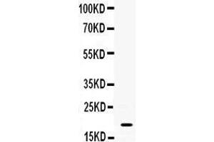Observed bind size: 19KD (S100A8 antibody  (AA 2-89))