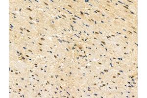 ABIN7093251 and ABIN7097268 at 1/100 staining Rat heart tissue by IHC-P. (ETS1 antibody  (pThr38))