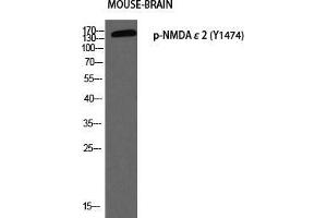 Western Blot (WB) analysis of Mouse Brain using p-NMDAepsilon2 (Y1474) antibody. (NMDA epsilon 2 (pTyr1474) antibody)