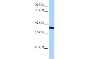 RPLP0 antibody used at 0. (RPLP0 antibody  (N-Term))