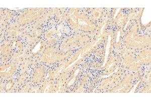 Detection of CD40L in Human Kidney Tissue using Monoclonal Antibody to Cluster Of Differentiation 40 Ligand (CD40L) (CD40 Ligand antibody  (AA 180-261))