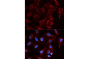 Immunofluorescence (IF) image for anti-Plakophilin 2 (PKP2) antibody (ABIN1876693) (Plakophilin 2 antibody)