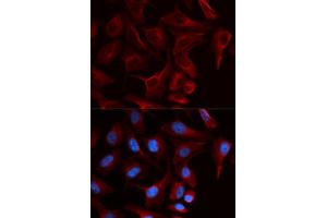 Immunofluorescence (IF) image for anti-Plakophilin 2 (PKP2) antibody (ABIN1876693) (Plakophilin 2 antibody)