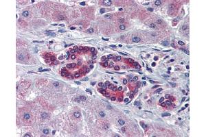 Immunohistochemistry (IHC) image for anti-T-Cell Acute Lymphocytic Leukemia 1 (TAL1) (C-Term) antibody (ABIN2792541)