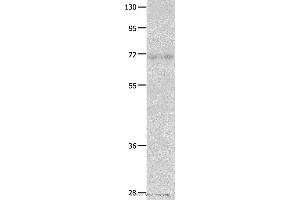 Western blot analysis of Human fetal lung tissue  , using IGF2BP1 Polyclonal Antibody at dilution of 1:500 (IGF2BP1 antibody)