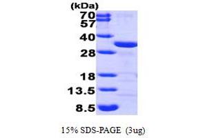 SDS-PAGE (SDS) image for Chloride Intracellular Channel 1 (CLIC1) (AA 1-241) protein (His tag) (ABIN666640)