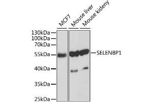 Western blot analysis of extracts of various cell lines, using SELENBP1 antibody. (SELENBP1 antibody)