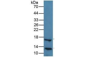 Western Blotting (WB) image for Lipase, Hepatic (LIPC) ELISA Kit (ABIN6574200)