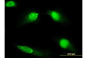Immunofluorescence of monoclonal antibody to DIAPH3 on HeLa cell. (DIAPH3 antibody  (AA 632-729))