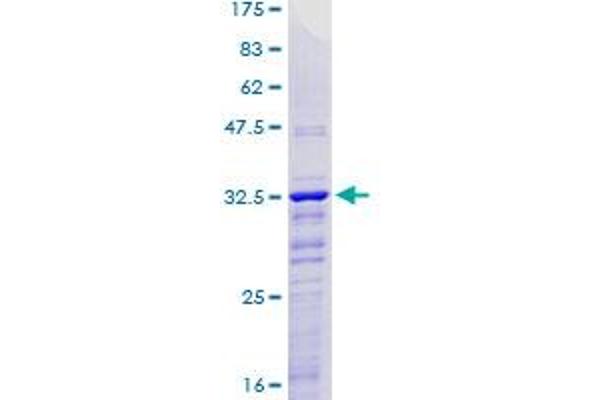 KLF2 Protein (AA 263-350) (GST tag)