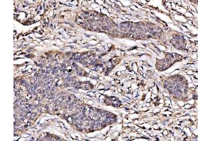 IHC analysis of PAK2 using anti-PAK2 antibody (ABIN7599219).