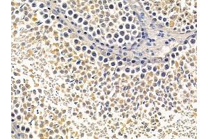 ABIN6257099 and ABIN6275623 at 1/100 staining rat testis tissue by IHC-P. (CCT5 antibody  (Internal Region))