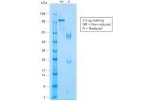 SDS-PAGE Analysis Purified p63 Rabbit Monoclonal Antibody (TP63/1423R). (p63 antibody)
