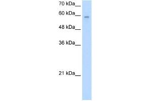 WB Suggested Anti-ARIH2 Antibody Titration:  2. (ARIH2 antibody  (N-Term))