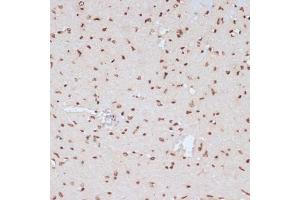 Immunohistochemistry (IHC) image for anti-Mitogen-Activated Protein Kinase 3 (MAPK3) (pTyr204) antibody (ABIN3019890)