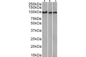Western Blot using anti-CD43 antibody 84-3C. (Recombinant CD43 antibody)
