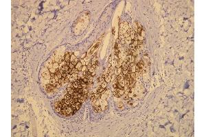 Immunohistochemistry (IHC) image for anti-Mucin 1 (MUC1) (C-Term) antibody (ABIN870416) (MUC1 antibody  (C-Term))