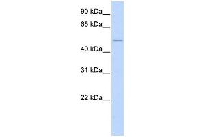 WB Suggested Anti-WNT2B Antibody Titration:  0. (WNT2B antibody  (N-Term))